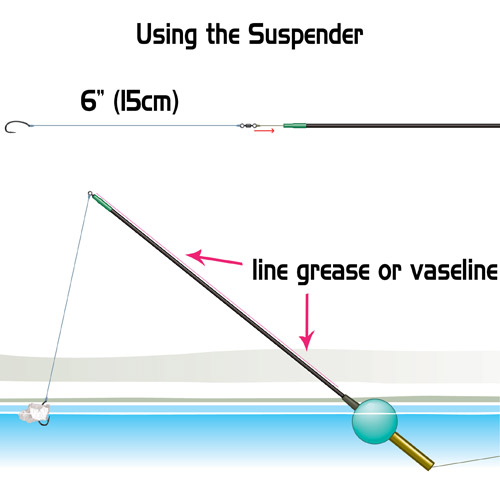 Gardner Suspender Diagram